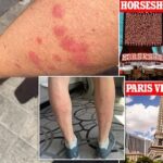 Two Las Vegas Strip Hotels Face Lawsuits After Guests Report Bed Bug Bites