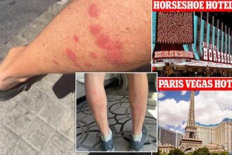Two Las Vegas Strip Hotels Face Lawsuits After Guests Report Bed Bug Bites