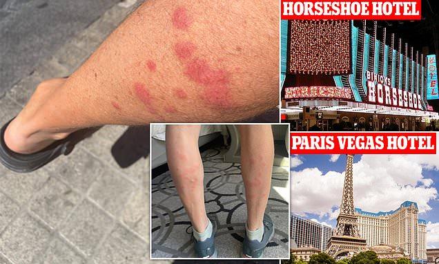 Two Las Vegas Strip Hotels Face Lawsuits After Guests Report Bed Bug Bites