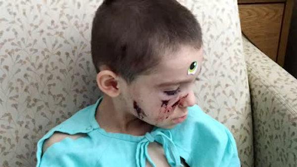 4-Year-Old Boy Critically Injured in SUV Accident; Woman Arrested for Child Abuse