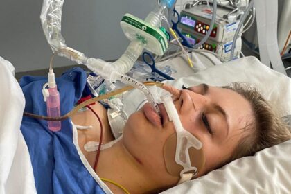Tragic Hit-and-Run Incident Claims Woman’s Life, Police Investigate