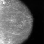 Las Vegas breast cancer survivor receives ‘horrifying’ letter. Her last 3 mammograms aren’t valid