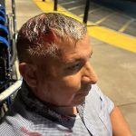 Man shot in the head with ‘less-than-lethal’ round at OC protest was victim of excessive force, lawsuit claims