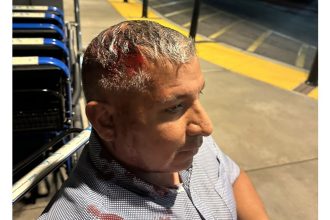 Man shot in the head with ‘less-than-lethal’ round at OC protest was victim of excessive force, lawsuit claims