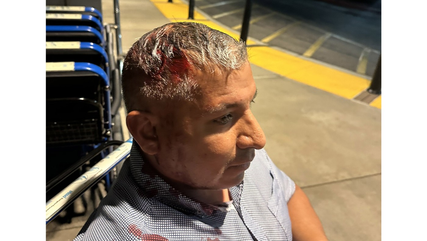 Man shot in the head with ‘less-than-lethal’ round at OC protest was victim of excessive force, lawsuit claims