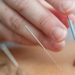 Ancient Medical Practices That Actually Worked