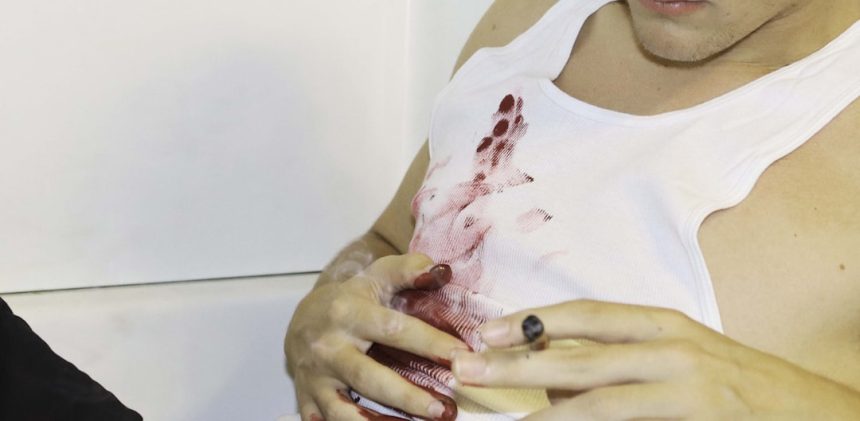 ‘Pulp Fiction’ actor died of accidental gunshot wound to his armpit